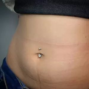 Фотография Syndrome Tattoo 3